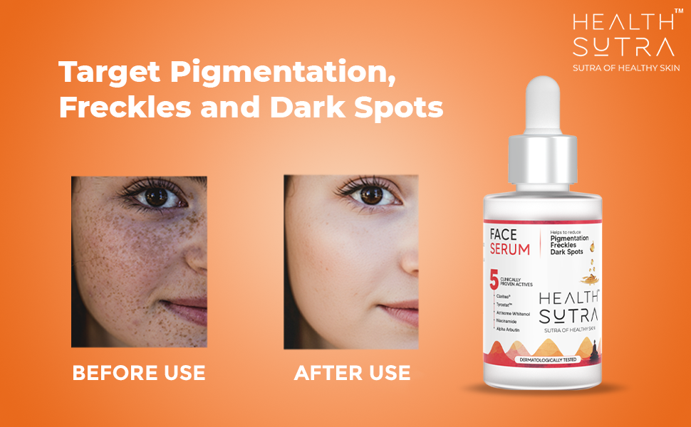 Advanced Daily Skin Health Kit with Anti Acne Facewash, Hyaluronic Sunscreen, Face Serum, Retinol Night Cream